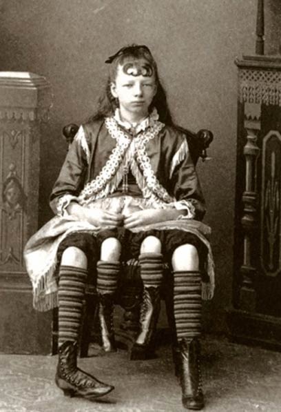 Миртл Корбин, четырехногая женщина Миртл Корбин, четырехногая женщина